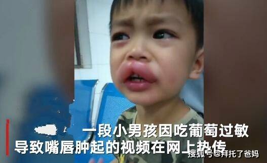 原创男孩吃完葡萄过敏肿成“嘟嘟嘴”，送医院后爸爸反应亮了！