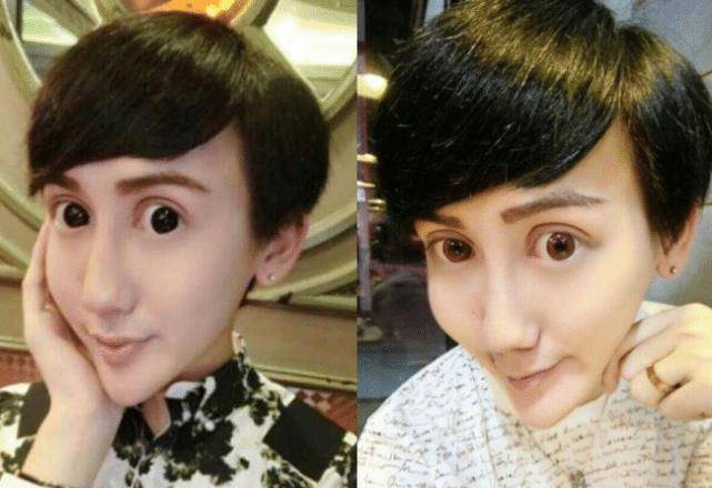 原创还记得整容失败成"蛇精脸"的刘梓晨吗?如今成功逆袭,颜值不输杨颖