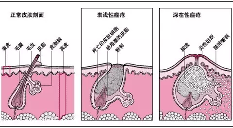 188fd38eea0d448cbc5fcfd8deda944b.png