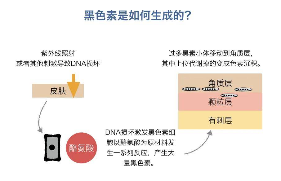 紫外线,炎症,皮肤破损,激素水平变化都会引起黑色素产生 大部分原因