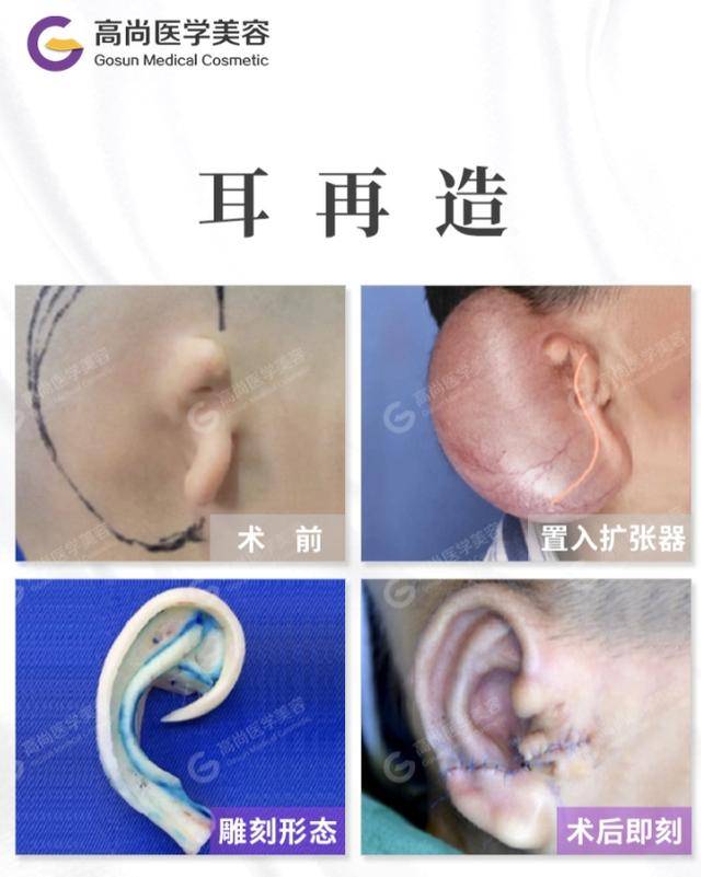 abb6172fc9a04a9496398dcd1203f915.jpeg