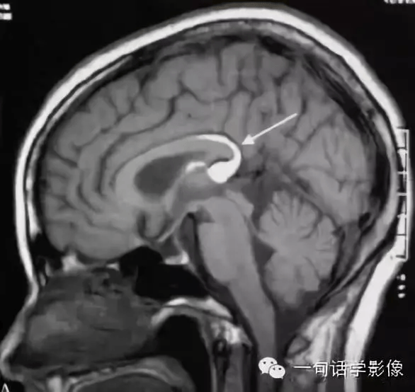 5bca520be8414d35b7c91f2d840b6c72.png