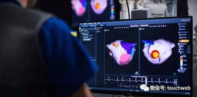 Acutus|医疗企业Acutus Medical上市：市值6.6亿美元 专治心律不齐