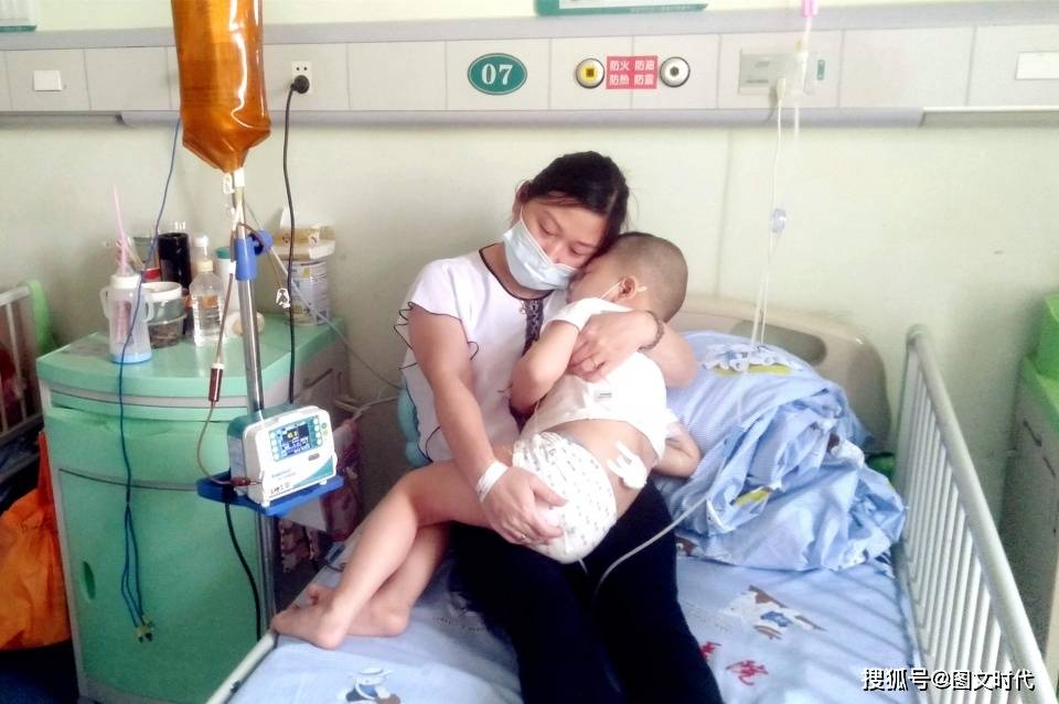 劫难|哥哥挺过来后被毁容,弟弟仍生死难料兄弟俩同在4岁遭劫难