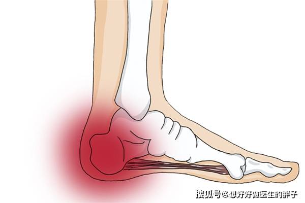 受伤如何缓解疼痛 9492ccd6520d4ed5b055cc1326420f7e.jpeg