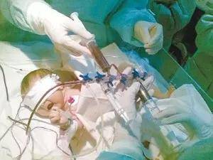 治疗|竟然需要“换血”!夺命黄疸!出生仅6天的宝宝黄疸