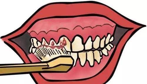 如何刷牙不会有口臭 764257f0c8ab42d2844e26f6b3094a6e.jpeg