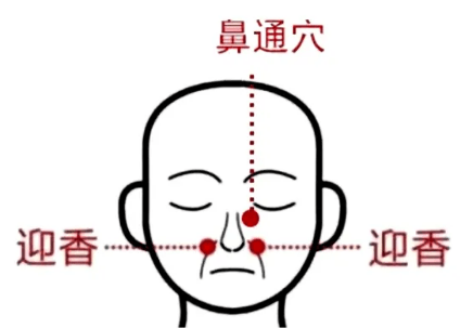 迎香穴和鼻通穴在哪里 84b0d6f244f44a498ea6c3fad7aedf53.png