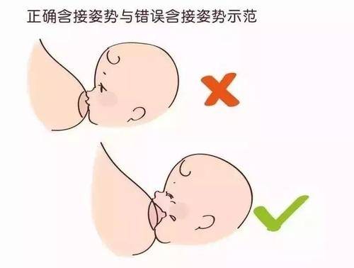 树袋宝宝哺乳期乳头皲裂又疼又影响哺乳怎么办