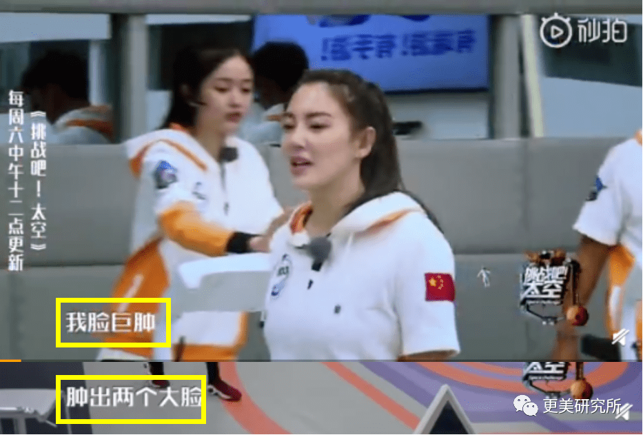 fa|金莎的脸肿成了黄圣依1.5倍，这是又do了？