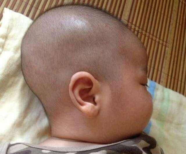 孩子后脑勺平平的真的好看吗 有没有必要故意把宝宝后脑勺睡平