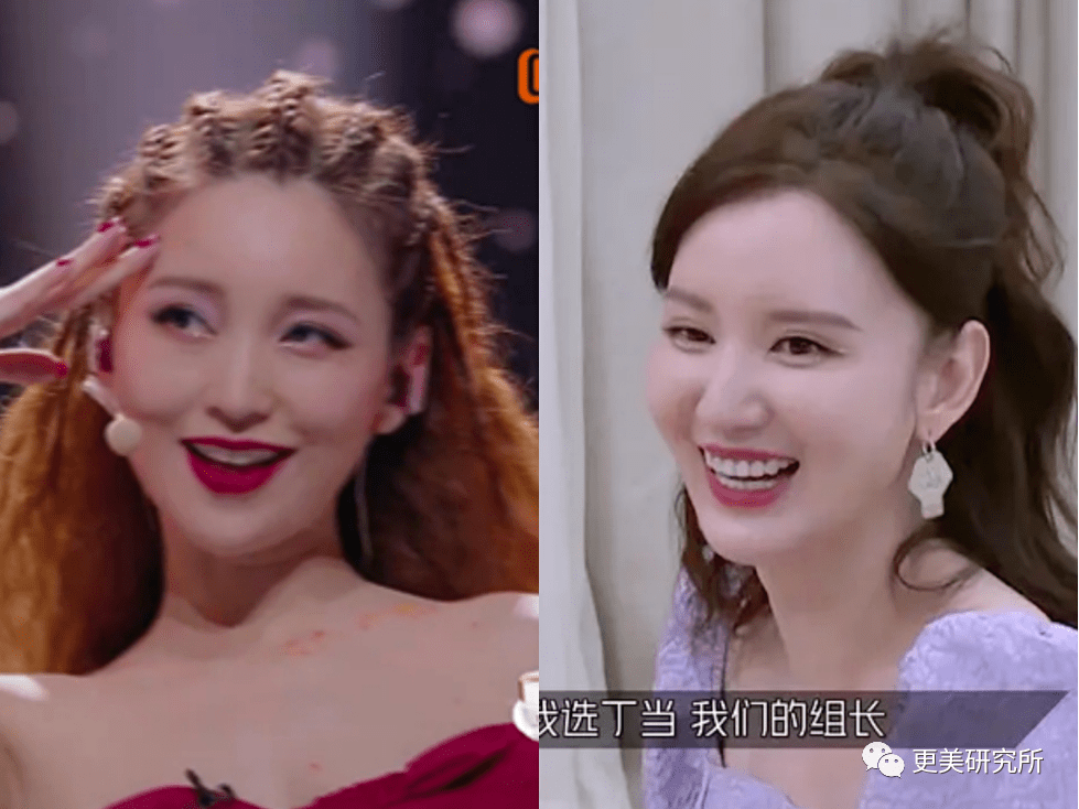 fa|金莎的脸肿成了黄圣依1.5倍，这是又do了？