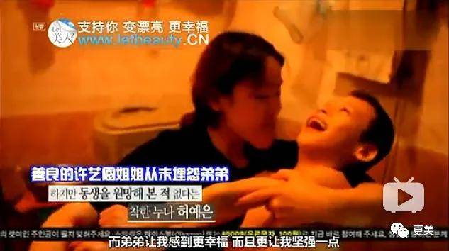 手术|回访|花3000万从“野兽”整成芭比的女孩，8年后过得怎么样