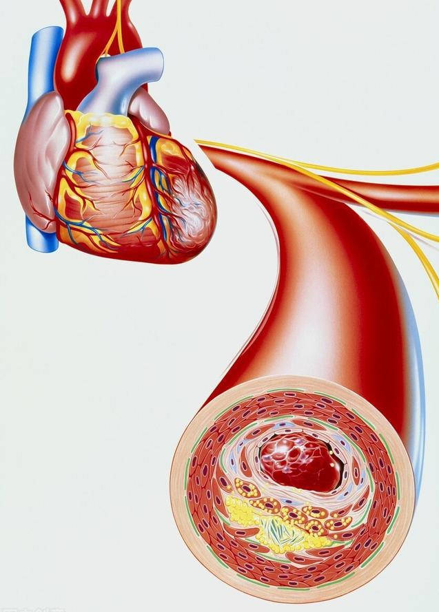 高血压挑战血管的负荷高血脂一点点硬化血管糖尿病让血管失控