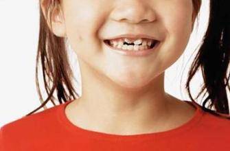 为何孩子小时候牙齿漂亮，长大后却变丑？