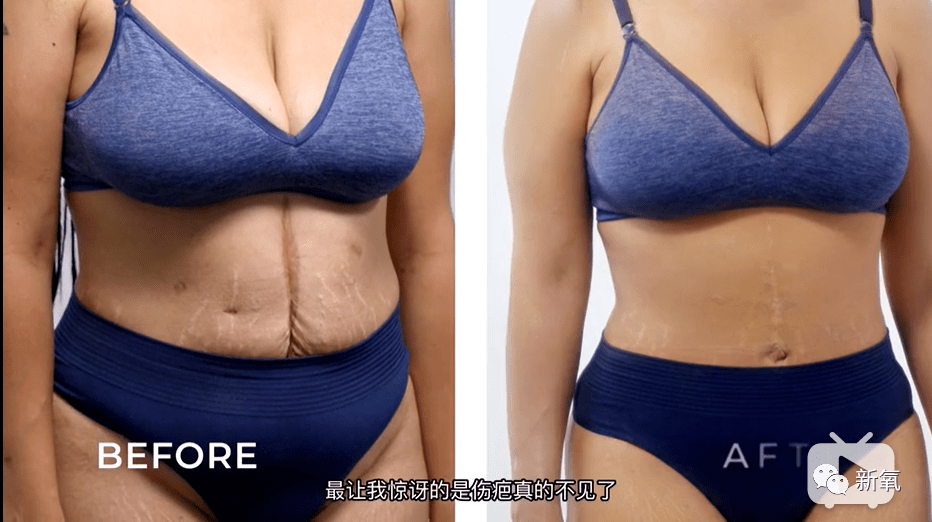 公敌|刘诗诗最新生图流出，生完孩子这张脸，真女明星公敌！！