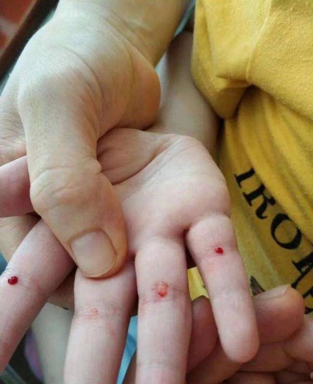 婆婆|第一个就中招了带娃路上的这7个坑