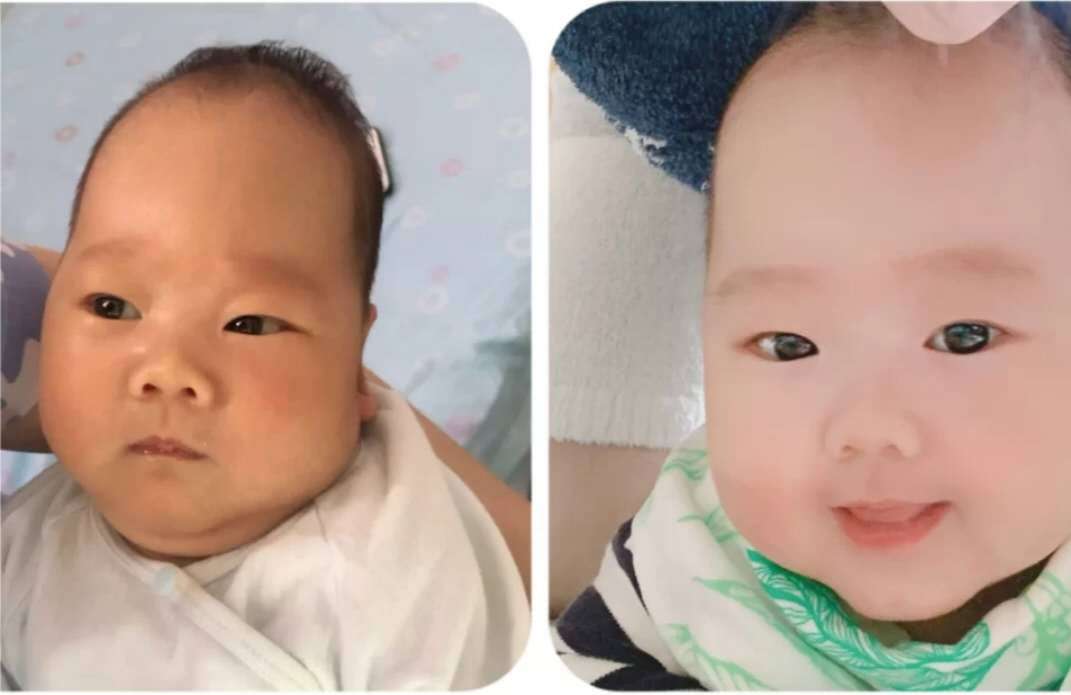 新生儿|反而预示高颜值，宝宝：逆袭的我你高攀不起新生儿这几个部位丑
