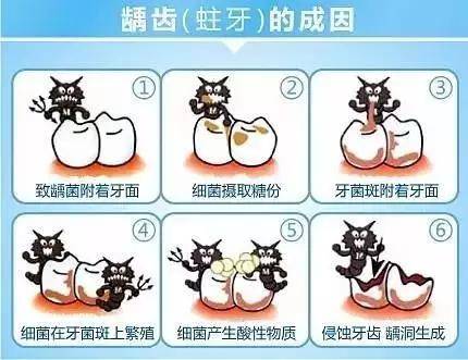 虫牙|元凶却不是糖3岁儿童满口“虫牙”