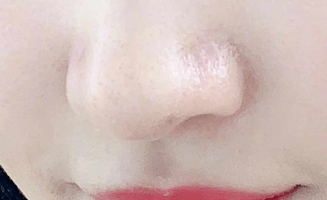 镜子|以前拿央视镜头当镜子，现在十级滤镜都磨不平，刘亦菲鼻子到底咋了？