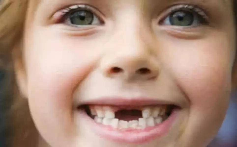 儿牙微科普:12岁前必须处理的12种儿牙颌畸形