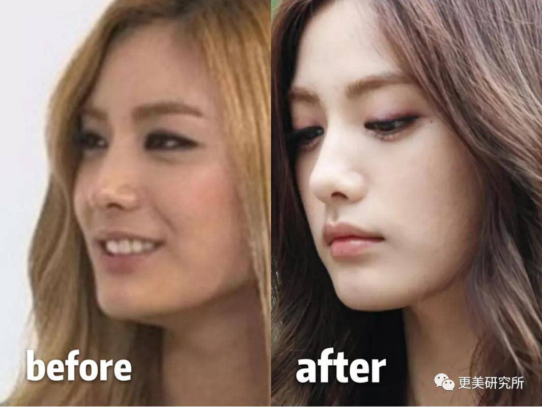 do|20年不崩的do圈C位,鞠婧祎baby都求她医生,堪称医学奇迹