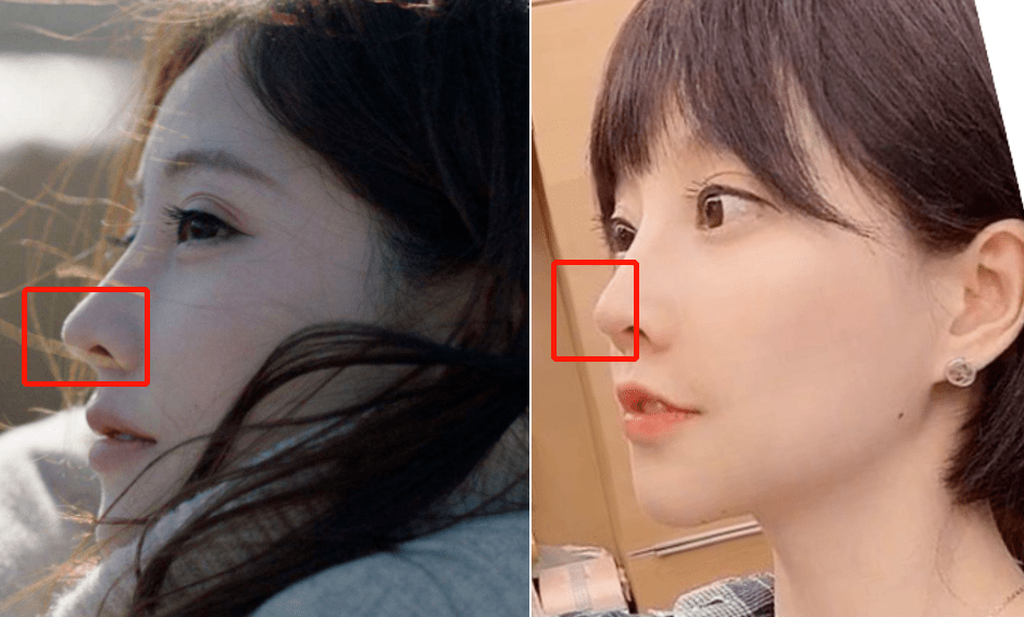 do|冯提莫这是后遗症出来了还是do了两次？搞成猪鼻子了…