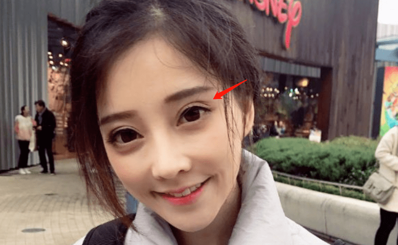 do|冯提莫这是后遗症出来了还是do了两次？搞成猪鼻子了…