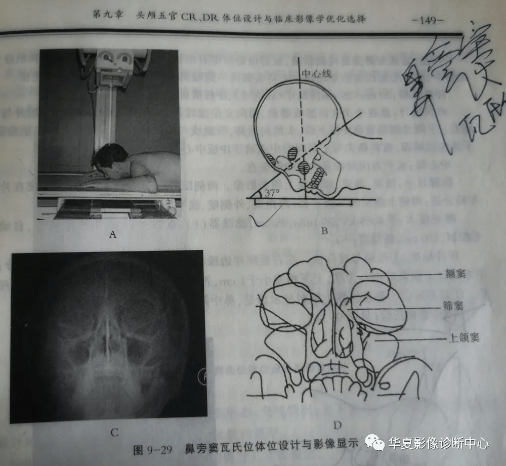 10种头部特殊摄影体位你会读片吗