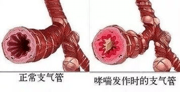 e75715d8ec9d4be884ee0d574471e3fc.png