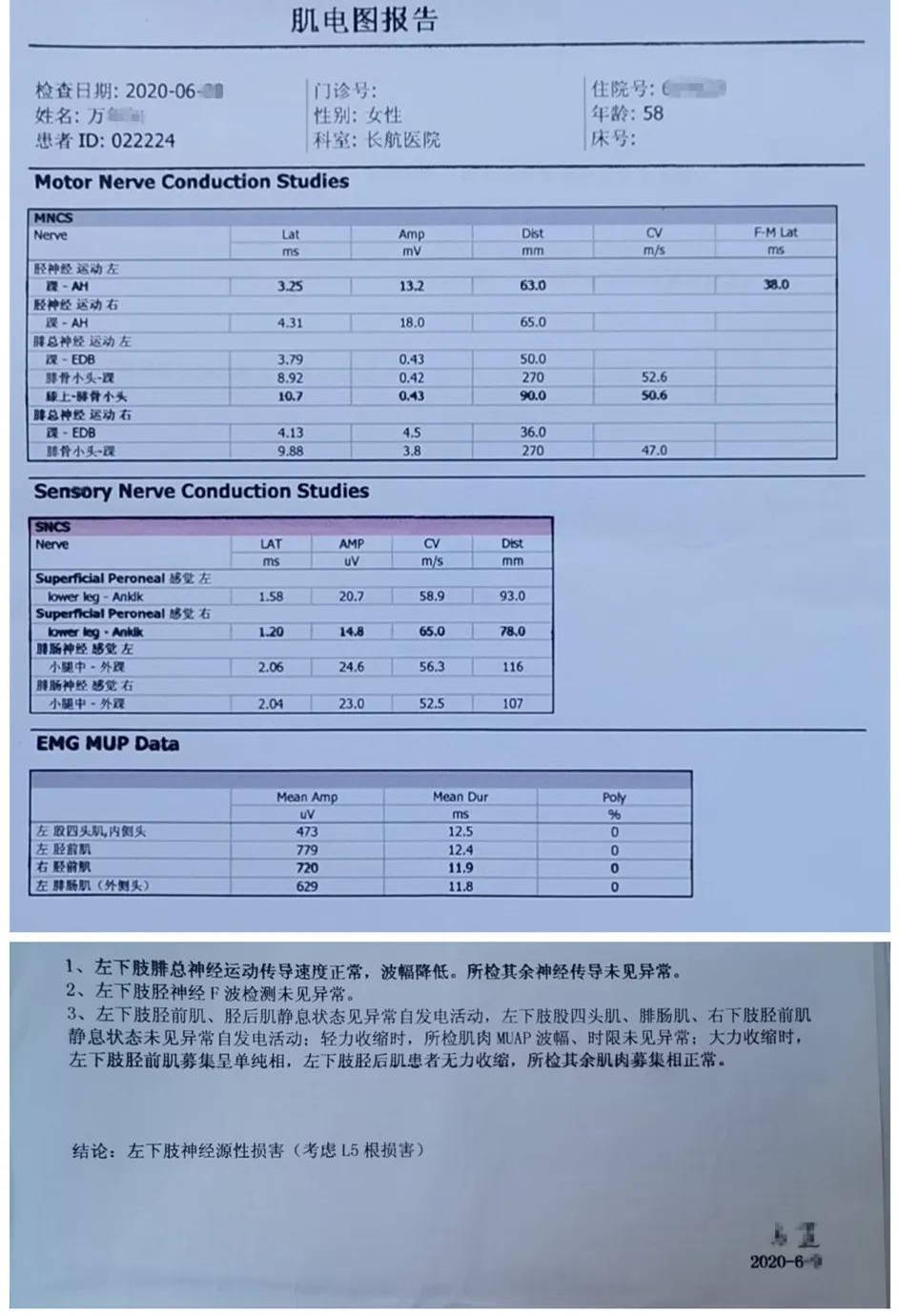 万阿姨的肌电图报告