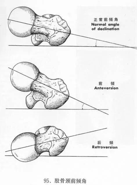 坐姿|36号公园推荐：可怕！这种错误的坐姿，会导致孩子腿部畸形？