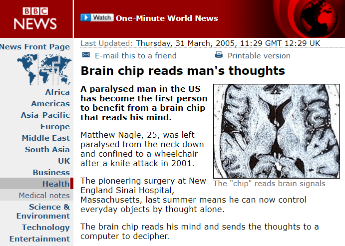 马斯克|马斯克这个让网友们高潮的脑机接口，真的挺弱的