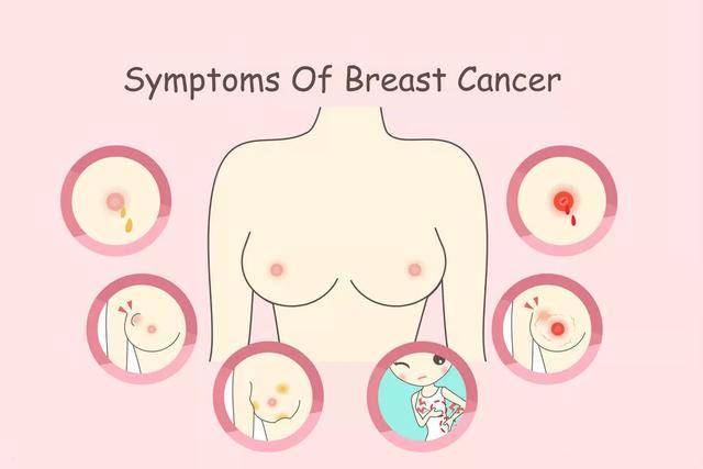 乳房早期诊断很重要!