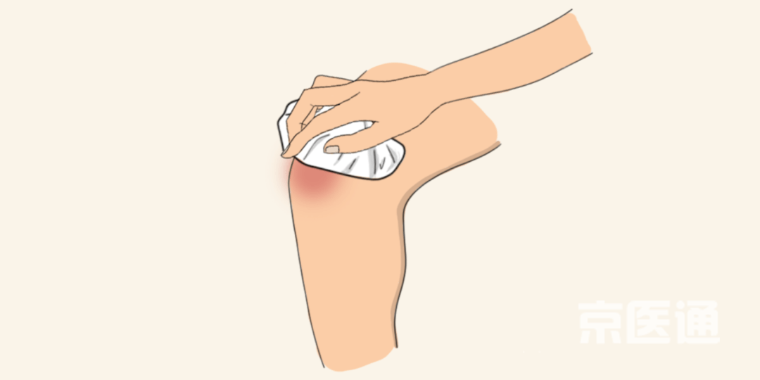京医通崴脚落枕痛风常见的十种情况该热敷还是冷敷