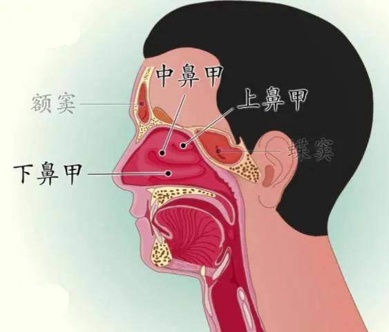 得了鼻息肉一定要手术吗?_鼻腔