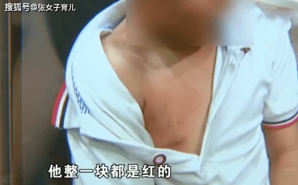 店家|餐馆吃饭孩子被烫伤，家长找店家负责，被网友吐槽：无理取闹