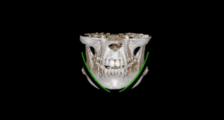 底子|骨相差生逆袭南韩第一时髦精，全智贤都压不住？！