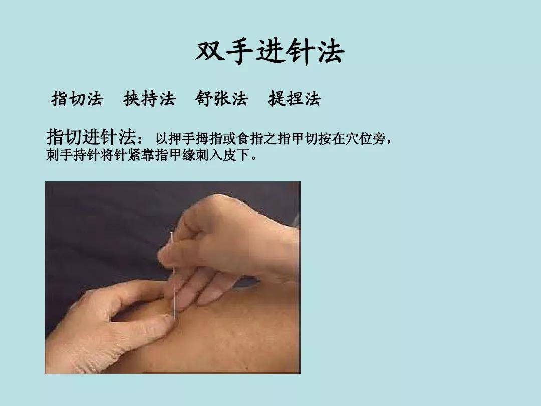 中医针灸流程表:持针,进针,行针,出针