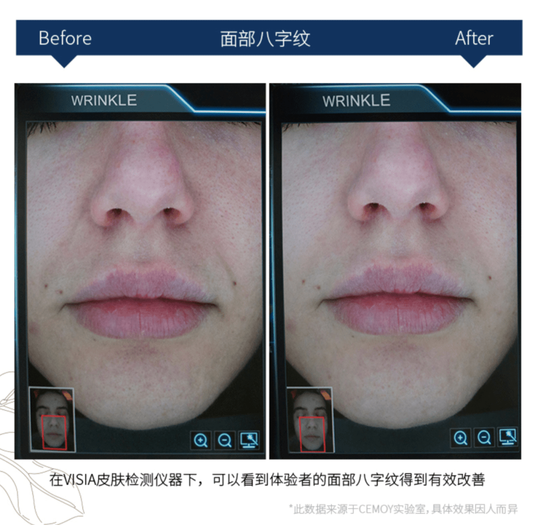 绿茶|节目自曝想当绿茶？她低调十年再度翻红挑战新角色...