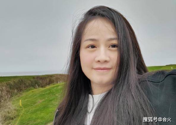 茶艺|原创岳云鹏老婆生病后首晒照，利落短发双眼肿胀憔悴，身形也消瘦不少