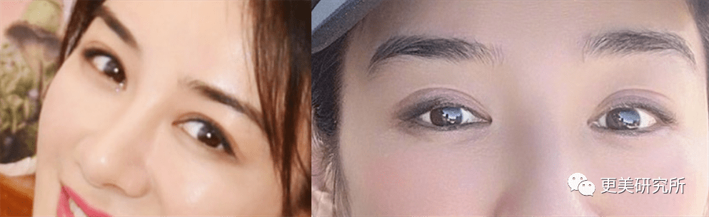 郭碧婷|比奚梦瑶、郭碧婷都惨的“豪门弃妇”，43岁颜值回春、好会do！