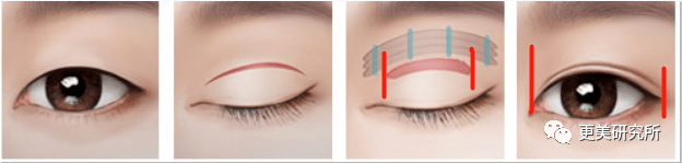 郭碧婷|比奚梦瑶、郭碧婷都惨的“豪门弃妇”，43岁颜值回春、好会do！