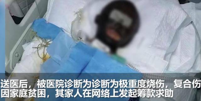 老人口发黑_人口普查