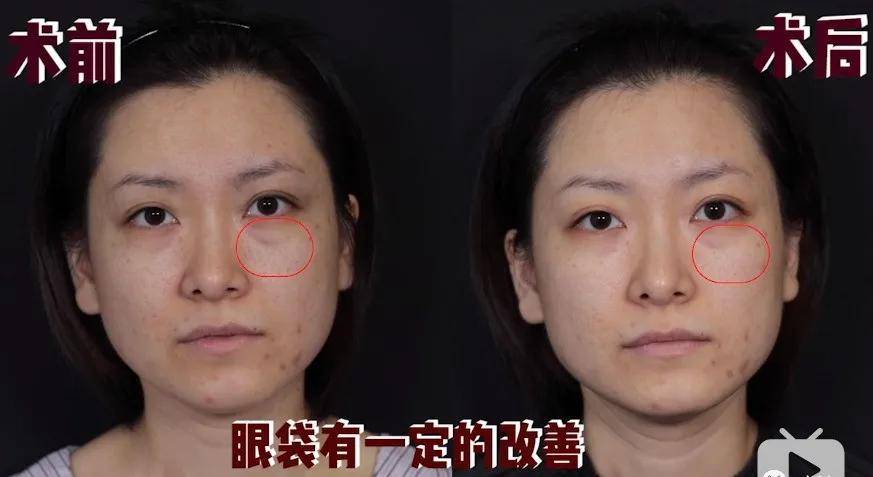 鞠婧祎|央视镜头的照妖镜下，鞠婧祎彻底翻车，被嘲土丑的她却逆天翻盘?