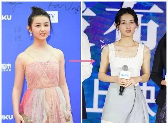张子枫|曾被关晓彤秒成渣，如今“整容式”长大，削掉斜方肌后美翻