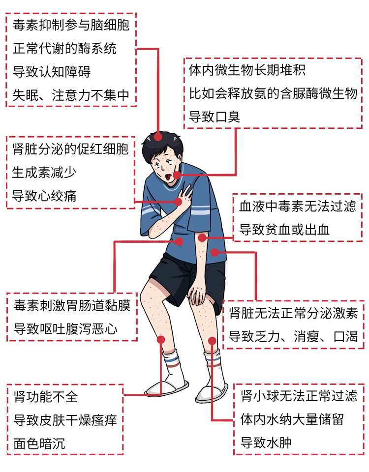 食物|「尿毒症」越来越多，医生提醒：少吃这些食物，肾病不敢找你麻烦