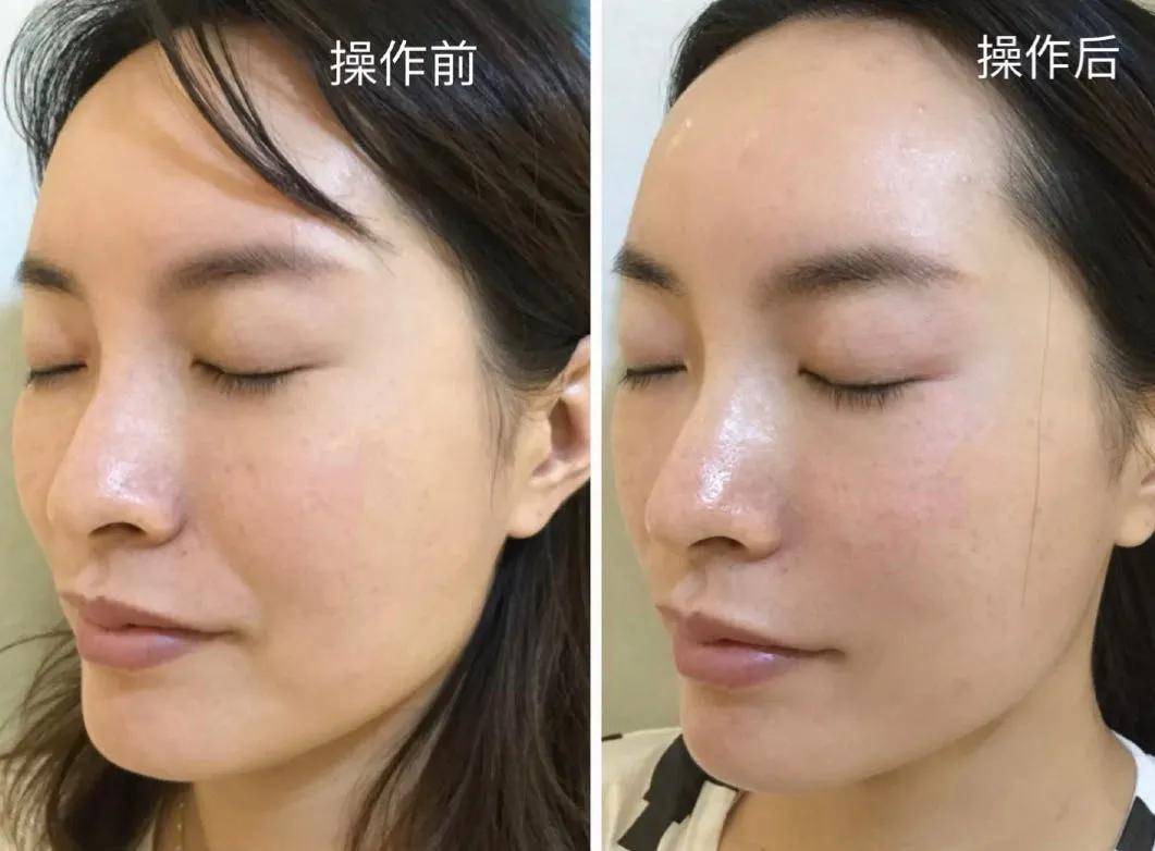 fa|央视镜头太可怕了,张天爱鼻子顶破天,被李沁吊打…