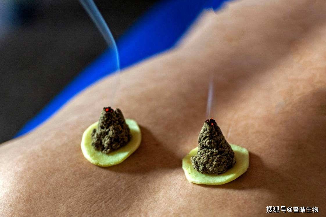 艾灸减肥有效果吗？艾灸减肥的原理是什么？暨晴生物和大家一起来揭秘。