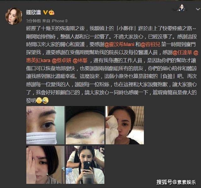 阿娇公布伤口细节照：长长的伤痕清晰可见，看